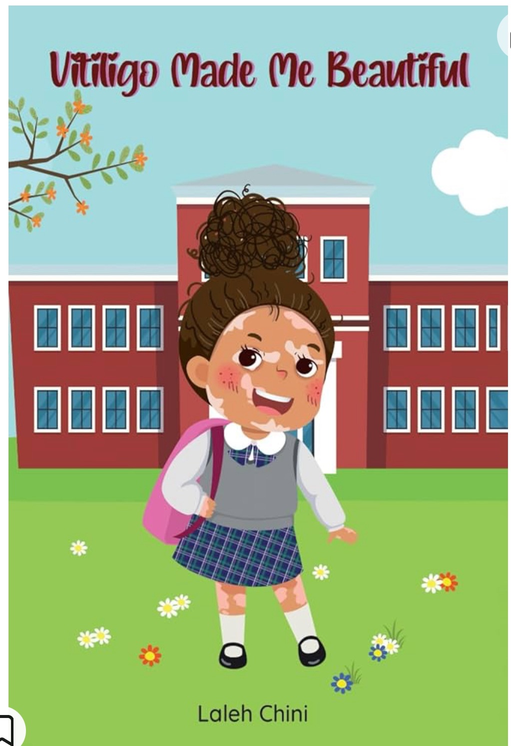 #stopbullyingforvitiligo